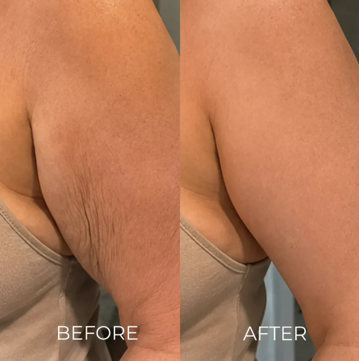Nuvessie Tri-Lift Peptide Cream™ Toxin for Visibly Firmer, smoother, And More Radiant Skin- Anywhere lt Ages