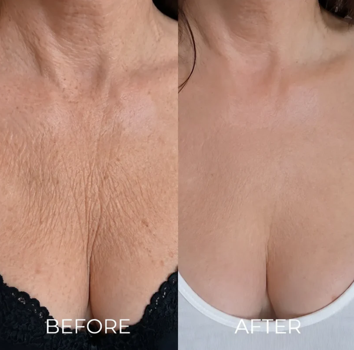 Nuvessie Tri-Lift Peptide Cream™ Toxin for Visibly Firmer, smoother, And More Radiant Skin- Anywhere lt Ages
