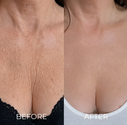 Nuvessie Tri-Lift Peptide Cream™ Toxin for Visibly Firmer, smoother, And More Radiant Skin- Anywhere lt Ages