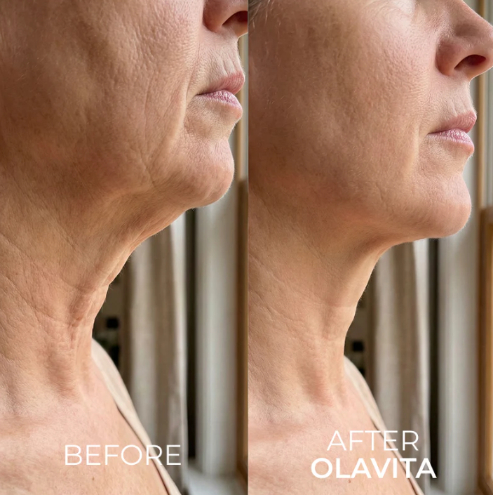 Nuvessie Tri-Lift Peptide Cream™ Toxin for Visibly Firmer, smoother, And More Radiant Skin- Anywhere lt Ages